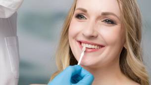 Veneers für die Zähne – Verblendschalen als Alternative zum Bleaching