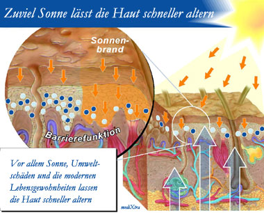 Falten, Hautbild, Faltenbehandlung, Peeling, Sonneneinwirkung