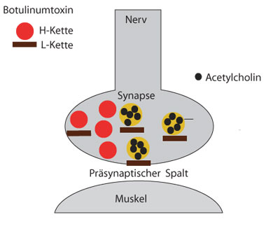 Botulinumtoxin: Blockade der Acetylcholinfreisetzung durch die leichte Kette von Botolinumtoxin A