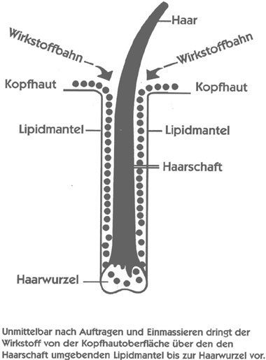 Haarausfall - Phytopharmaka hilft gegen Haarausfall