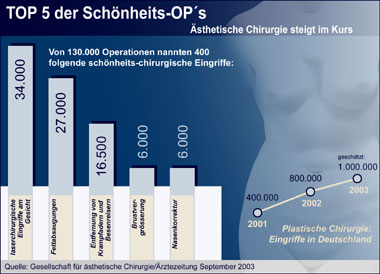 Plastische Chirurgie: Top 5 der Schönheitsoperationen (Infografik)