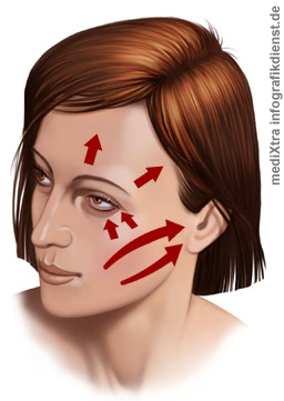 Facelift - Schoenheitschirurgie - Verjüngung - Rejuvenation Procedure