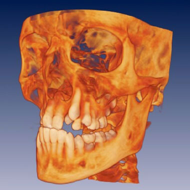 Knochenvisualisierung - Abt. für Kiefer- und Gesichtschirurgie, Klinik für Wiederherstellende Chirurgie, Universitätsspital Basel