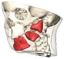 Mund-, Kiefer- und Gesichtschirurgie: Numerische Modellierung des Gesichts für eine optimale Operationsplanung